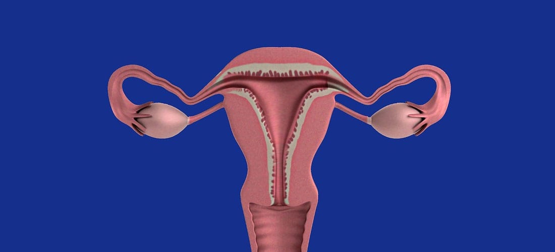 Endometrioza: Simptome și cum să scapi de ea