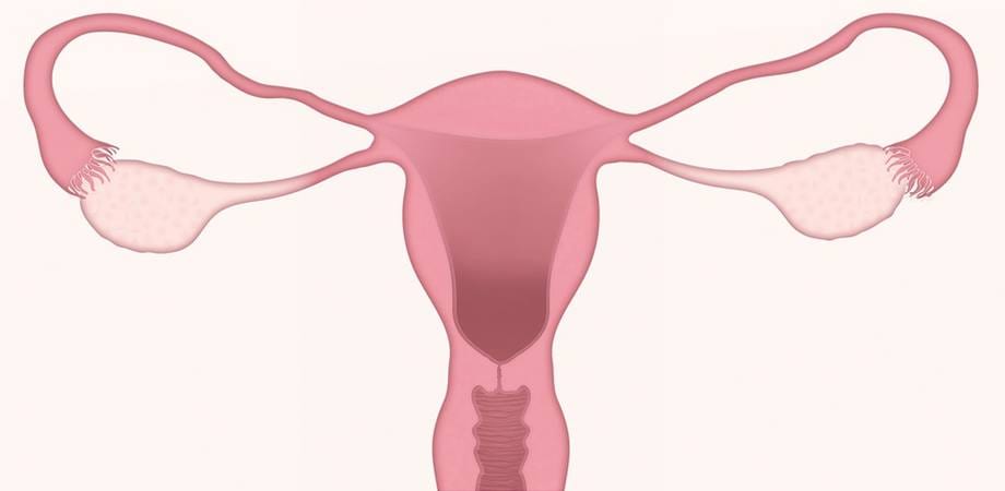 cancerul trompelor uterine info