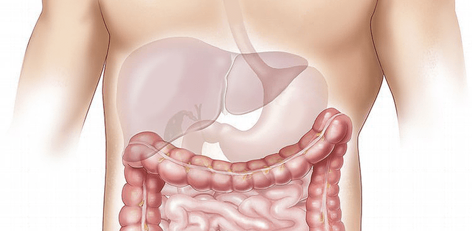 colostomia si ileostomia