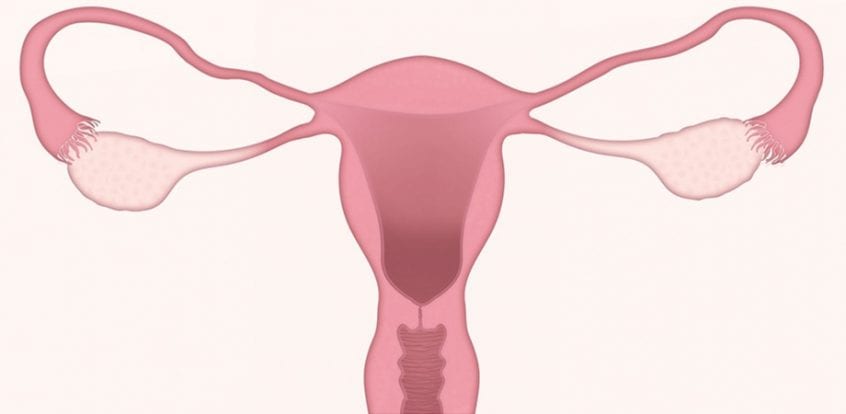 Colposcopie – tot ce trebuie să ştii despre această procedură, Condiloame cervicale pe colposcopie