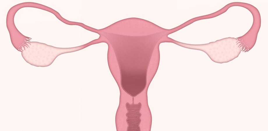 polipi și negi pe colul uterin