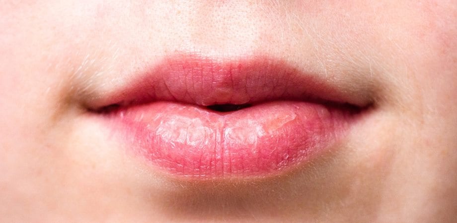 Senzația de gură uscată poate anunța boli grave. Vezi care sunt