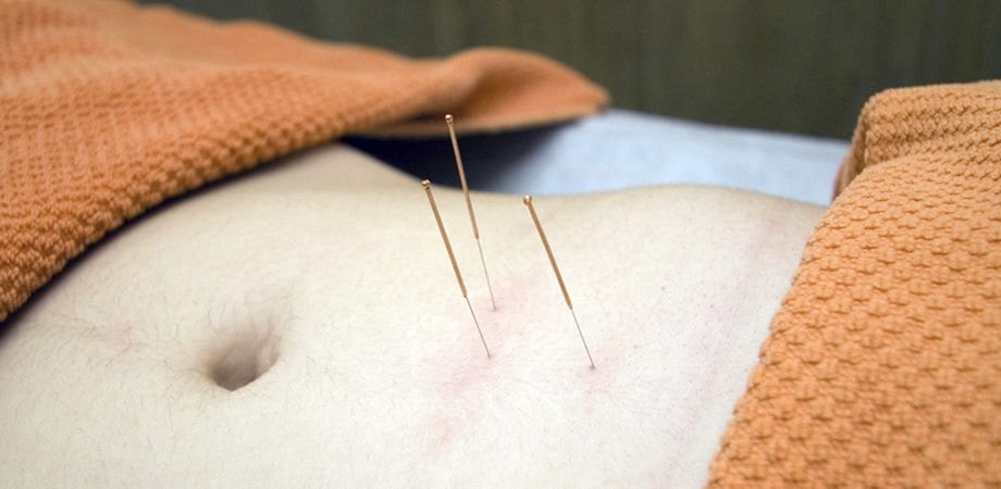Puncte de acupunctură pentru tratamentul prostatitei