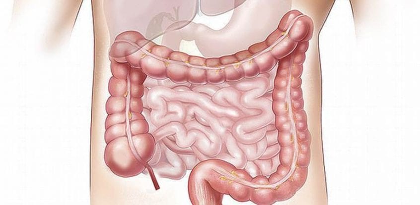 cancerul de colon simptome si cauze tratamentul parazitului amway