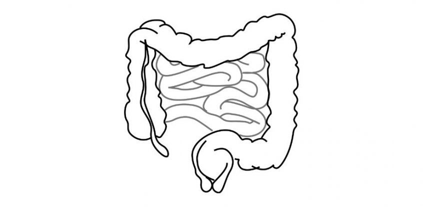 ocluzia intestinala