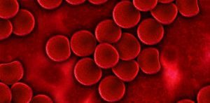 Eritrocite crescute - ce inseamna si care sunt cauzele - Cancer360