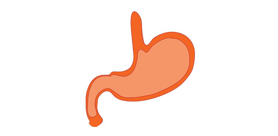 complicatii ulcer gastric